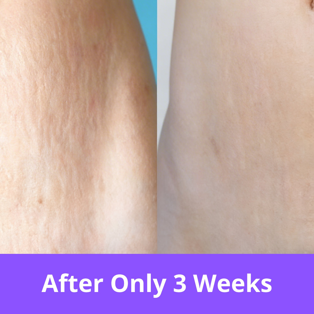 <h2><strong>Just 3 Minutes a Day with Growingra</strong></h2>