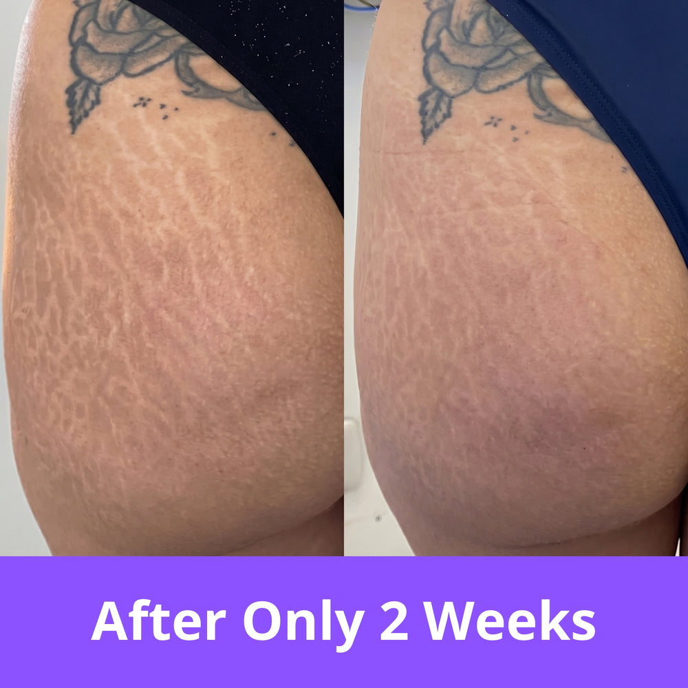 <h2><strong>Just 3 Minutes a Day with Growingra</strong></h2>